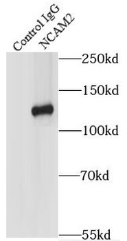 NCAM2 Rabbit Polyclonal Antibody