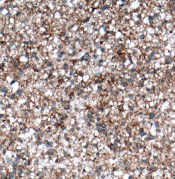 NCAM2 Rabbit Polyclonal Antibody
