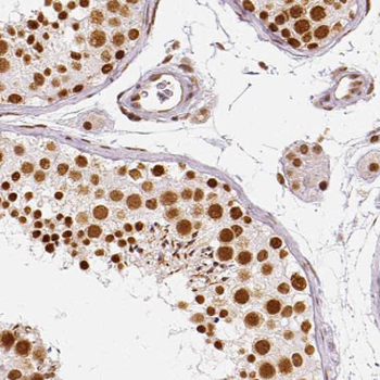 NCAPG Rabbit Polyclonal Antibody