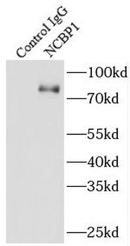 NCBP1 Antibody