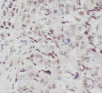 NCBP1 Antibody