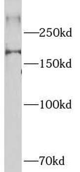 NCOR2 Antibody