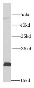 NCS1 Rabbit Polyclonal Antibody