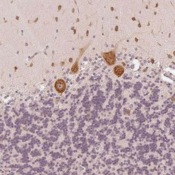 NCS1 Rabbit Polyclonal Antibody