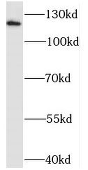 SLC8A1 Rabbit Polyclonal Antibody