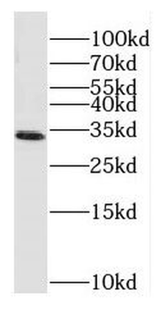 MT ND1 Rabbit Polyclonal Antibody