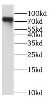 NDC80 Rabbit Polyclonal Antibody