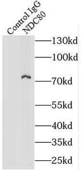 NDC80 Rabbit Polyclonal Antibody