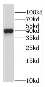 NDEL1 Rabbit Polyclonal Antibody