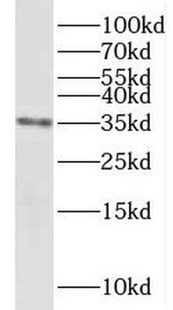 NDUFAF1 Antibody