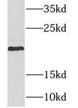 NDUFAF4 Rabbit Polyclonal Antibody