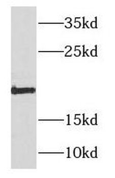 NDUFB11 Rabbit Polyclonal Antibody