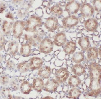 NDUFB11 Rabbit Polyclonal Antibody