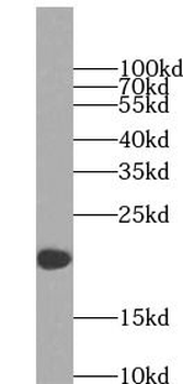 NDUFB8 Rabbit Polyclonal Antibody