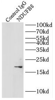NDUFB8 Rabbit Polyclonal Antibody