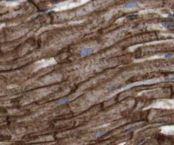 NDUFB8 Rabbit Polyclonal Antibody