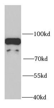 NDUFS1 Rabbit Polyclonal Antibody