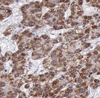 NDUFS1 Rabbit Polyclonal Antibody