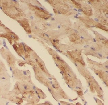 NDUFS5 Rabbit Polyclonal Antibody