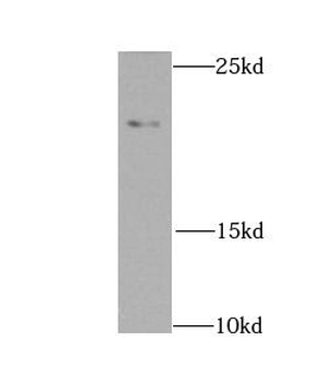 NDUFS7 Rabbit Polyclonal Antibody