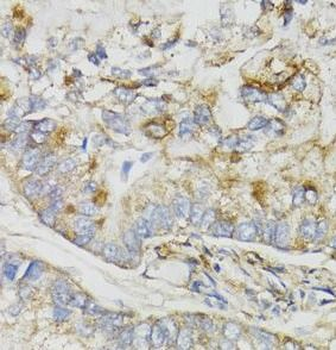 NDUFS7 Rabbit Polyclonal Antibody