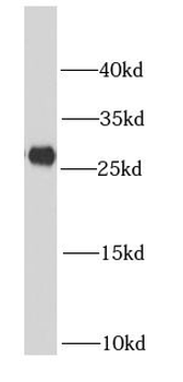 NDUFV2 Rabbit Polyclonal Antibody