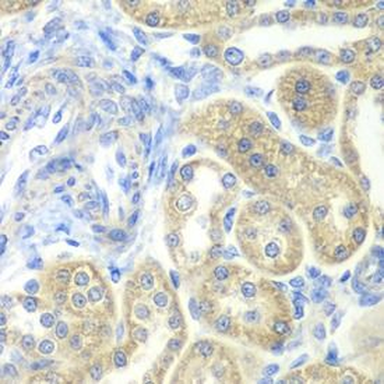 NDUFV2 Rabbit Polyclonal Antibody