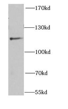 NEDD4L Antibody