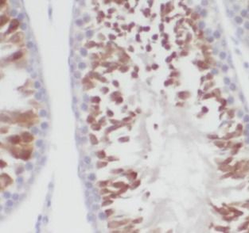 NEK2 Rabbit Polyclonal Antibody