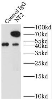 NF2 Antibody