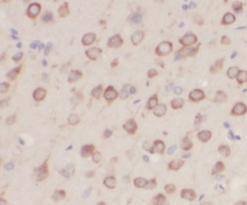 NF2 Antibody