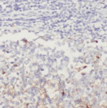 NFAM1 Rabbit Polyclonal Antibody