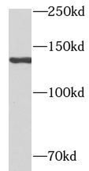 NFATC3 Rabbit Polyclonal Antibody