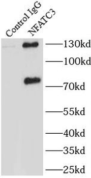 NFATC3 Rabbit Polyclonal Antibody