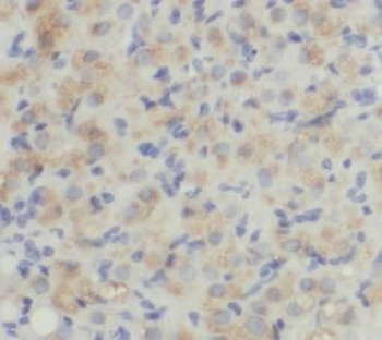 NFATC3 Rabbit Polyclonal Antibody