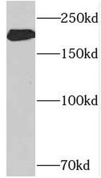 NEFH Antibody