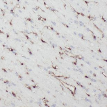 NEFH Antibody