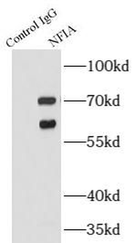 NFIA Rabbit Polyclonal Antibody