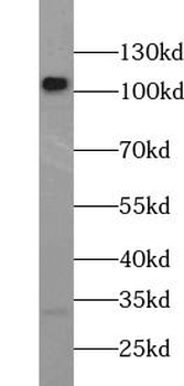 NFKB2 Rabbit Polyclonal Antibody