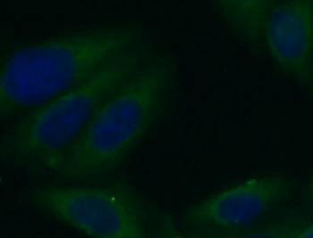 NFKB2 Rabbit Polyclonal Antibody