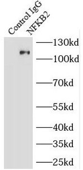 NFKB2 Rabbit Polyclonal Antibody