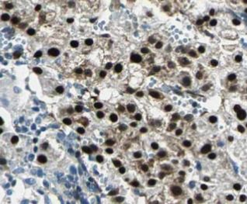 NFKB2 Rabbit Polyclonal Antibody