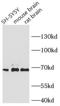 NEFL Rabbit Polyclonal Antibody