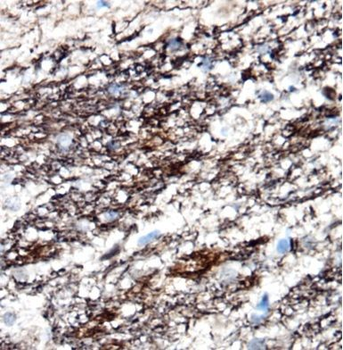 NEFL Rabbit Polyclonal Antibody