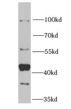 NFS1 Rabbit Polyclonal Antibody