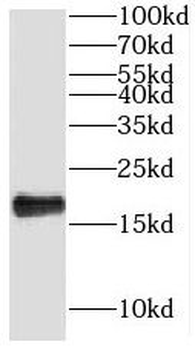 NHP2 Rabbit Polyclonal Antibody