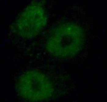 NHP2 Rabbit Polyclonal Antibody