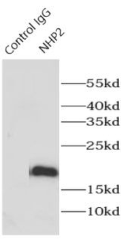 NHP2 Rabbit Polyclonal Antibody