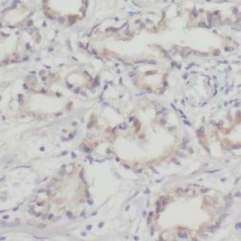 NHP2 Rabbit Polyclonal Antibody