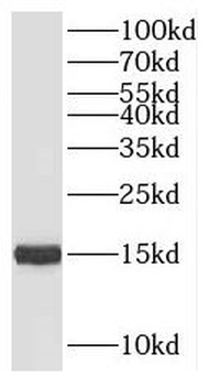 SNU13 Rabbit Polyclonal Antibody